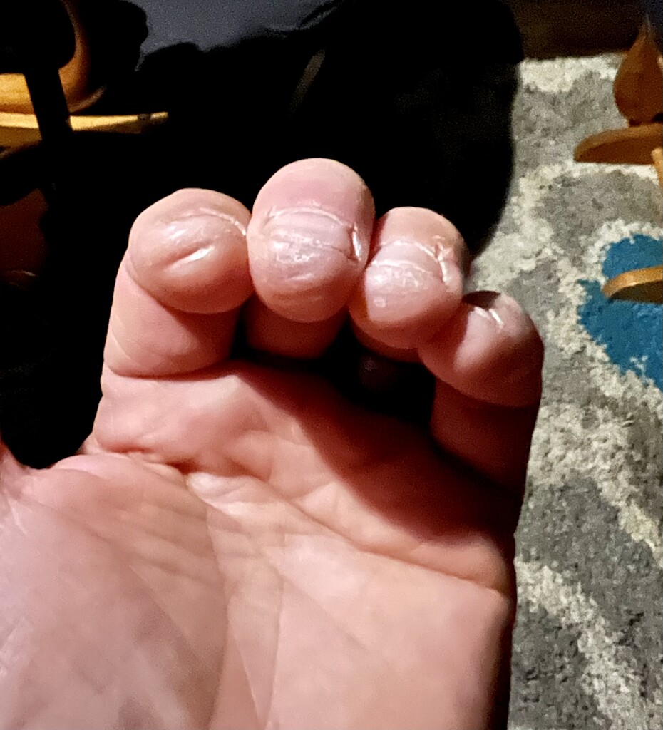 Finger tips are indented JustinGuitar Community